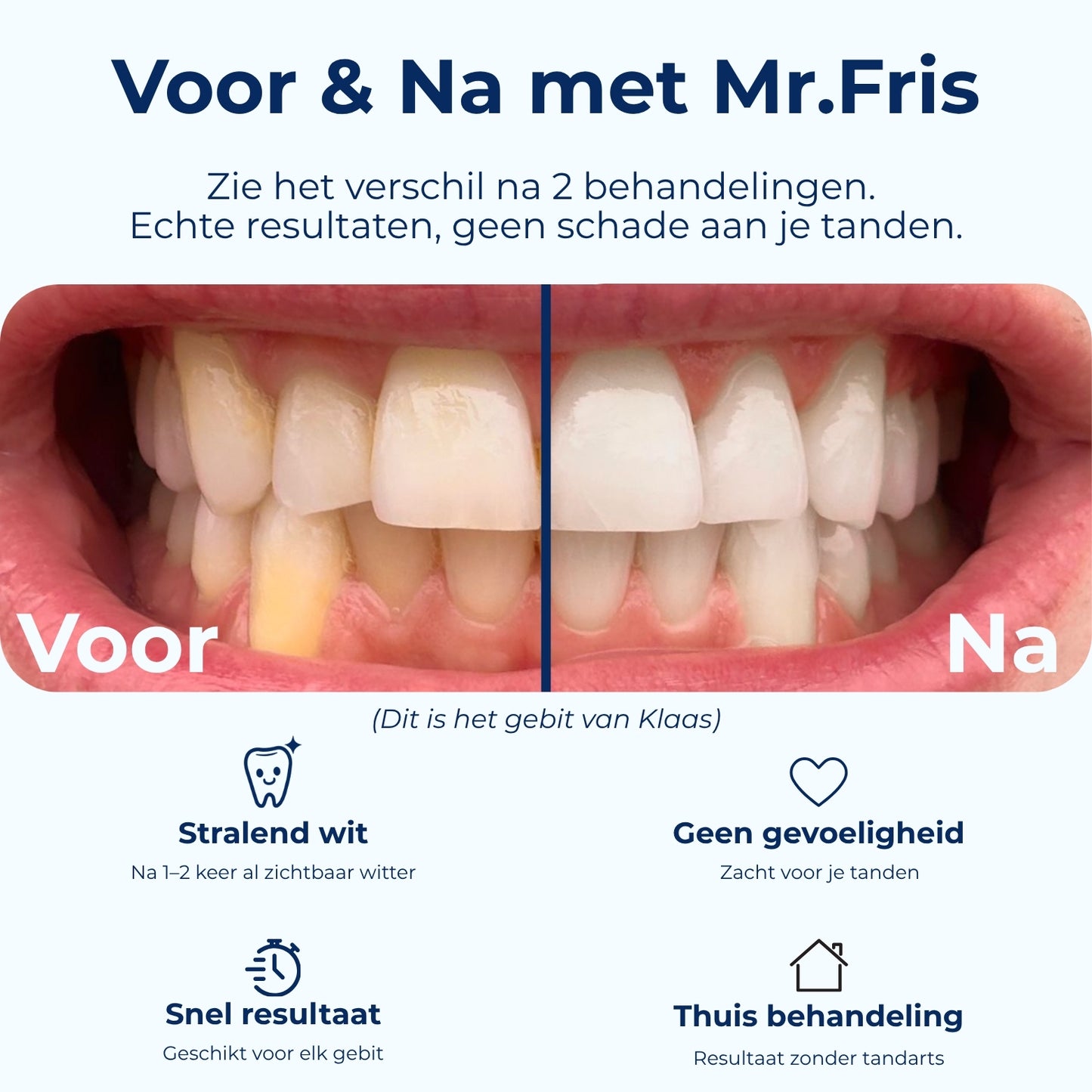 Mr.Fris Bleekbitjes