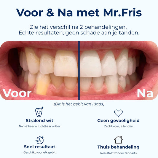 Mr.Fris Bleekbitjes