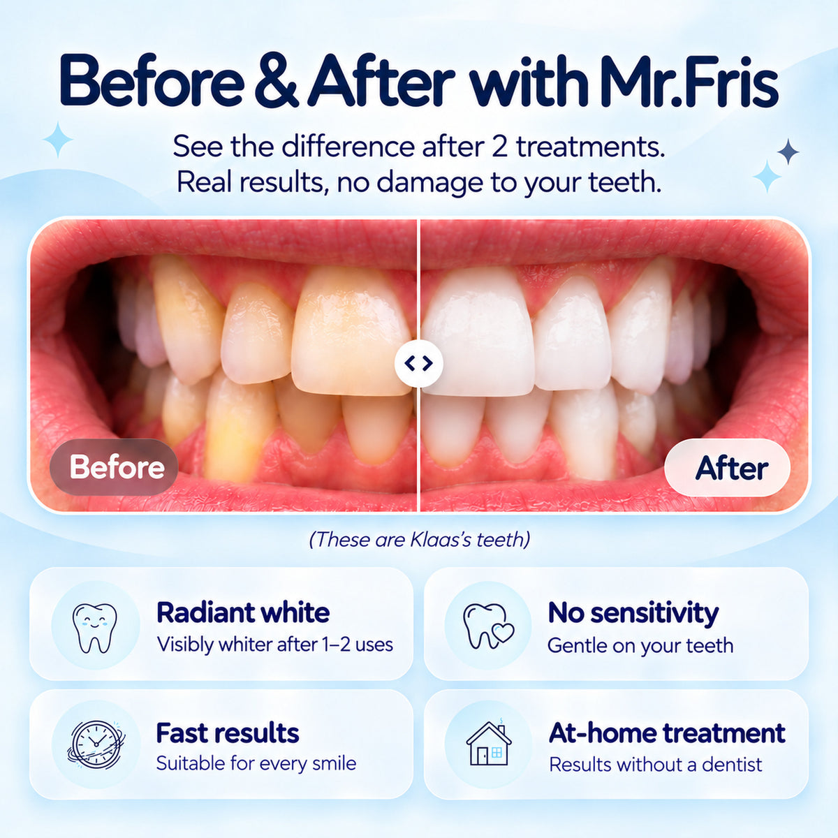 Mr.Fris Whitening trays