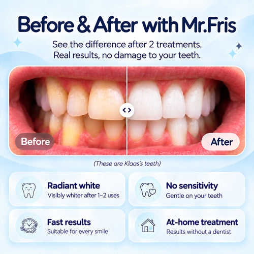 Mr.Fris Whitening trays